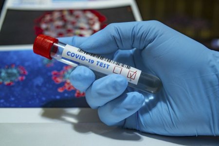 Koronavirus infeksiyasına daha 4170 yoluxma faktı qeydə alınıb.